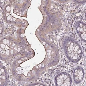 Merck Anti-MMP14 antibody produced in rabbit