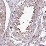 Merck Anti-CSDE1 antibody produced in rabbit
