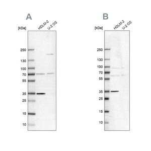 Merck Anti-TTC19 antibody produced in rabbit