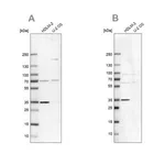 Merck Anti-TTC19 antibody produced in rabbit