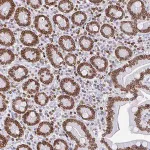 Merck Anti-BTBD7 antibody produced in rabbit