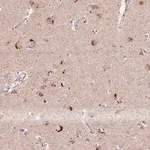Merck Anti-METTL13 antibody produced in rabbit