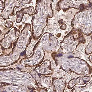Merck Anti-KLHL20 antibody produced in rabbit