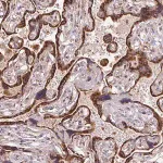 Merck Anti-KLHL20 antibody produced in rabbit