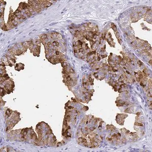 Merck Anti-TIMP1 antibody produced in rabbit