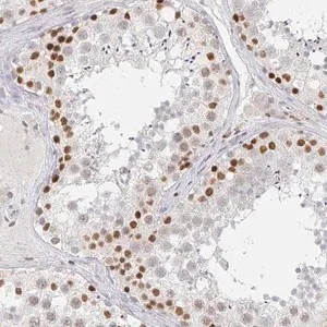 Merck Anti-RCOR1 antibody produced in rabbit