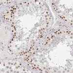 Merck Anti-RCOR1 antibody produced in rabbit