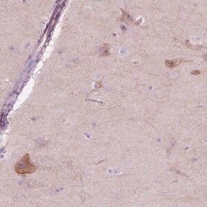 Merck Anti-NOS1AP antibody produced in rabbit