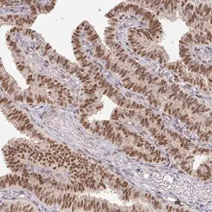 Merck Anti-MEIS1 antibody produced in rabbit
