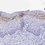 Merck Anti-FA2H antibody produced in rabbit
