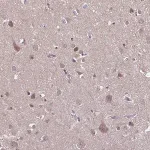 Merck Anti-DIP2B antibody produced in rabbit