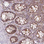 Merck Anti-GFPT2 antibody produced in rabbit