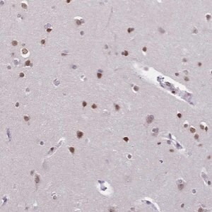 Merck Anti-CBX7 antibody produced in rabbit