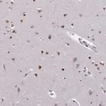 Merck Anti-CBX7 antibody produced in rabbit