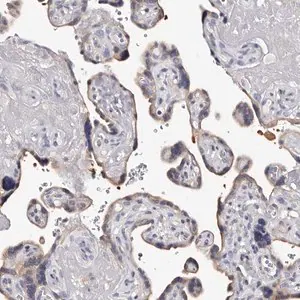 Merck Anti-EDNRB antibody produced in rabbit