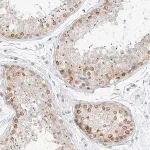 Merck Anti-NHSL1 antibody produced in rabbit