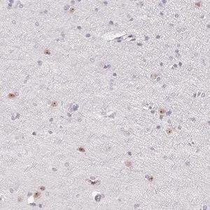 Merck Anti-ZIC4 antibody produced in rabbit