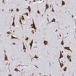 Merck Anti-RFK antibody produced in rabbit