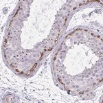 Merck Anti-GRK4 antibody produced in rabbit