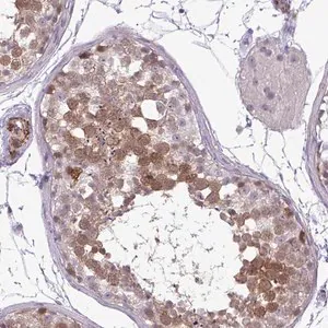 Merck Anti-UBE2S antibody produced in rabbit