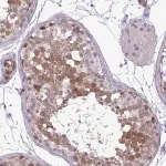 Merck Anti-UBE2S antibody produced in rabbit