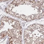 Merck Anti-DHRS12 antibody produced in rabbit
