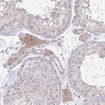 Merck Anti-C10orf90 antibody produced in rabbit