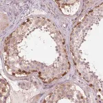 Merck Anti-SH3RF2 antibody produced in rabbit