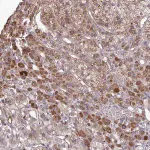 Merck Anti-B4GALT6 antibody produced in rabbit