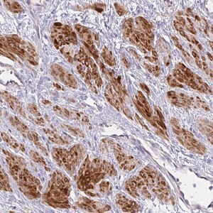 Merck Anti-MOCS1 antibody produced in rabbit