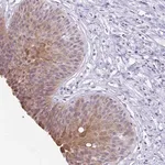 Merck Anti-ZFP64 antibody produced in rabbit