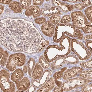 Merck Anti-AACS antibody produced in rabbit