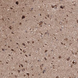 Merck Anti-BRWD1 antibody produced in rabbit