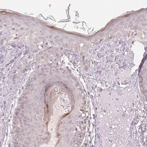 Merck Anti-KPRP antibody produced in rabbit