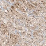 Merck Anti-ZBTB41 antibody produced in rabbit