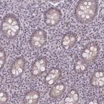 Merck Anti-NUDT16 antibody produced in rabbit