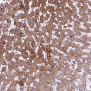 Merck Anti-AIG1 antibody produced in rabbit