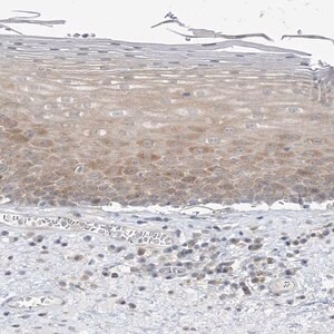 Merck Anti-THADA antibody produced in rabbit