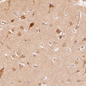 Merck Anti-ARHGAP26 antibody produced in rabbit