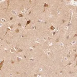 Merck Anti-ARHGAP26 antibody produced in rabbit