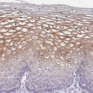 Merck Anti-CDC42BPG antibody produced in rabbit