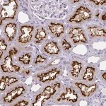 Merck Anti-BBS12 antibody produced in rabbit