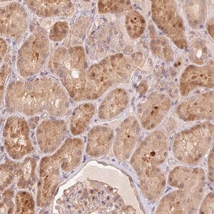 Merck Anti-NUDT16 antibody produced in rabbit