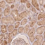 Merck Anti-NUDT16 antibody produced in rabbit