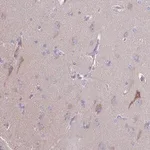 Merck Anti-PRR14L antibody produced in rabbit