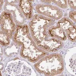 Merck Anti-SLC13A1 antibody produced in rabbit