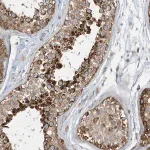 Merck Anti-SPATA5 antibody produced in rabbit