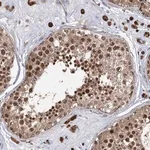 Merck Anti-SLC4A1AP antibody produced in rabbit