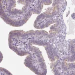 Merck Anti-VWA3B antibody produced in rabbit
