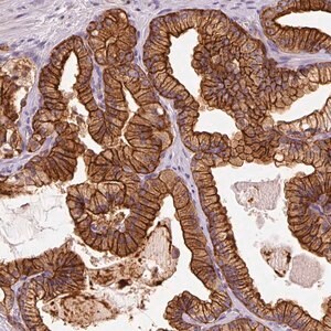 Merck Anti-IQGAP2 antibody produced in rabbit